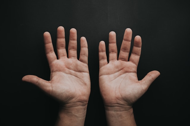 Correct sleeping posture with palms facing up